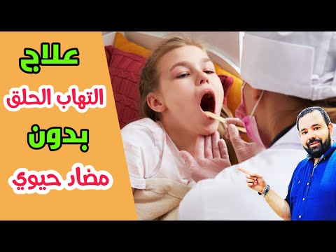 فيديو: كيفية علاج التهاب البلعوم عند الطفل