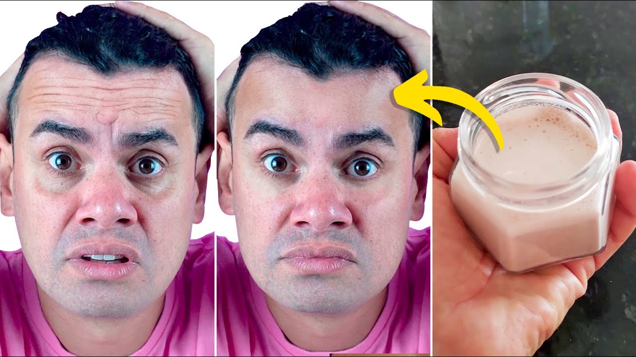 INGREDIENTE 1 MILHÃO DE VEZES MAIS FORTE QUE BOTOX (APLIQUE NO ROSTO QUE TEM RUGAS) - Fubá online