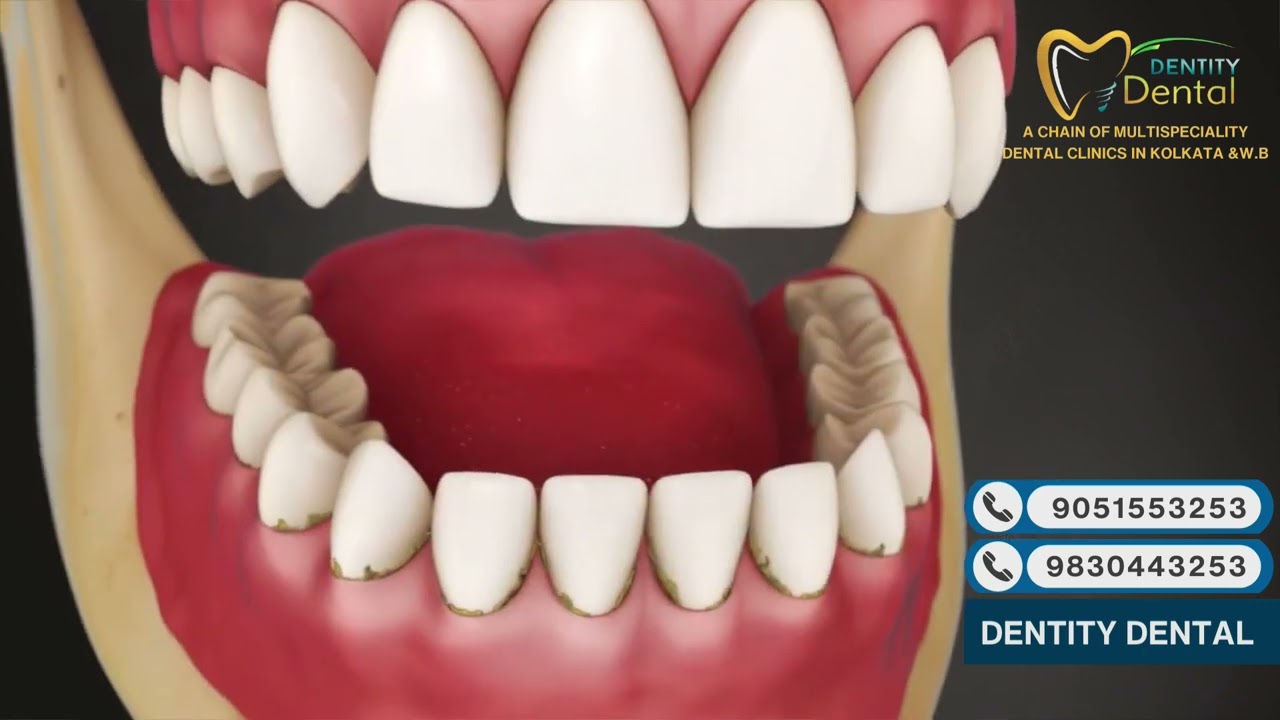 Dental Water Jet Explained | Benefits & Usage | Dentity Dental