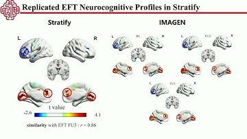 OHBM 2025 | Oral Session | Rongquan Zhai | A Generative Model Framework for Task-based fMRI: Integ…