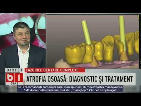 Cazuri dentare complexe: Caracteristici, provocări, soluții, Dr. Alexandru Georgescu, Apariție B1 TV