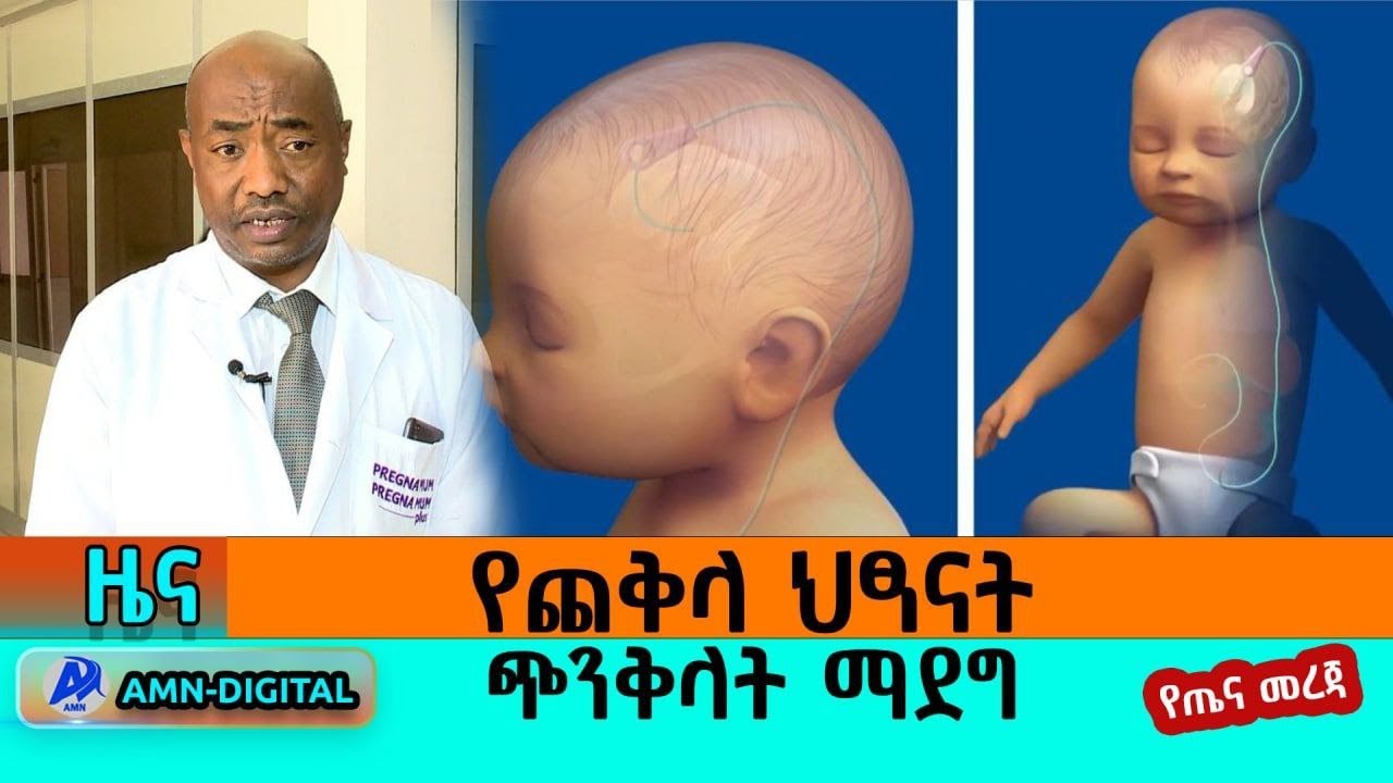 የጨቅላ ህፃናት ጭንቅላት ማደግ