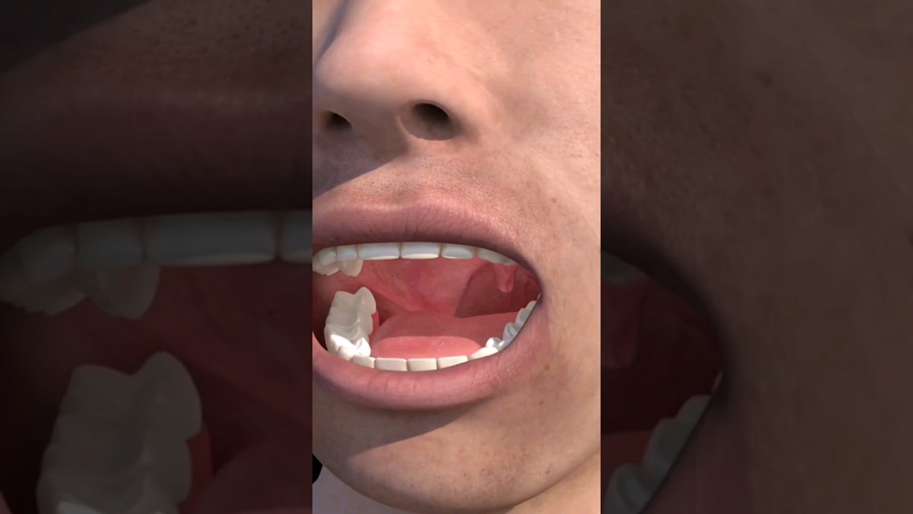 Tonsils 3d animation video Human body 
