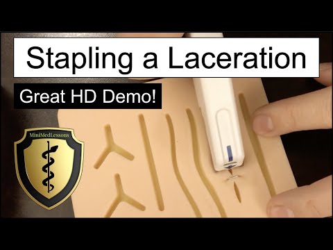 Closing a Laceration Using a Skin Stapler - Step-by-step instructions!