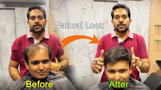 Hair Patch For Men | Hair Patch | Non Surgical Hair Treatment | 7874979663