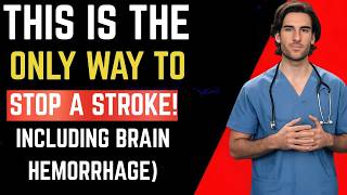 STROKE WARNING: You Have 3 Hours to Save Your Brain | FAST Emergency Protocol