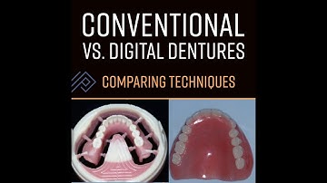S2578 Comparing Conventional vs. Digital Denture Techniques