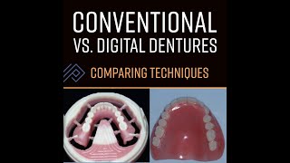 S2578 Comparing Conventional vs. Digital Denture Techniques