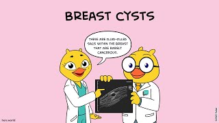 Breast Cysts