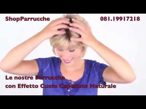 parrucche per chemioterapia napoli