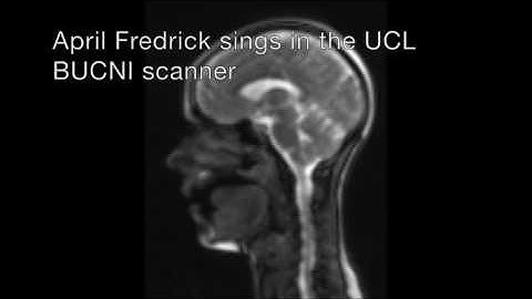 April Fredrick singing in the BUCNI scanner - dynamic MRI