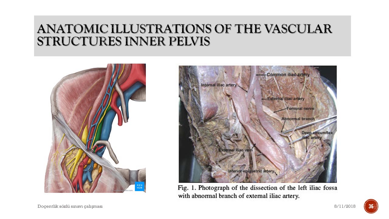 Primary Hip Arthroplasty