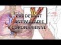 Maladie cardiaque et soins dentairecat devant un patient atteint dun infarctus du myocarde