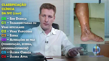 Quais os sintomas da insuficiência venosa?