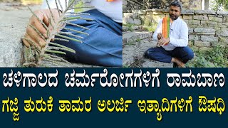 ಚಳಿಗಾಲದ ಚರ್ಮ ರೋಗಗಳಿಗೆ ಈ ಗಿಡ ರಾಮಬಾಣ | ಗಜ್ಜಿ ತುರುಕೆ ಅಲರ್ಜಿಗಳಿಗೆ ಔಷಧಿ | Remedy For Skin disease