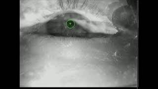 27. Real-time pupil detection on PupilNet III