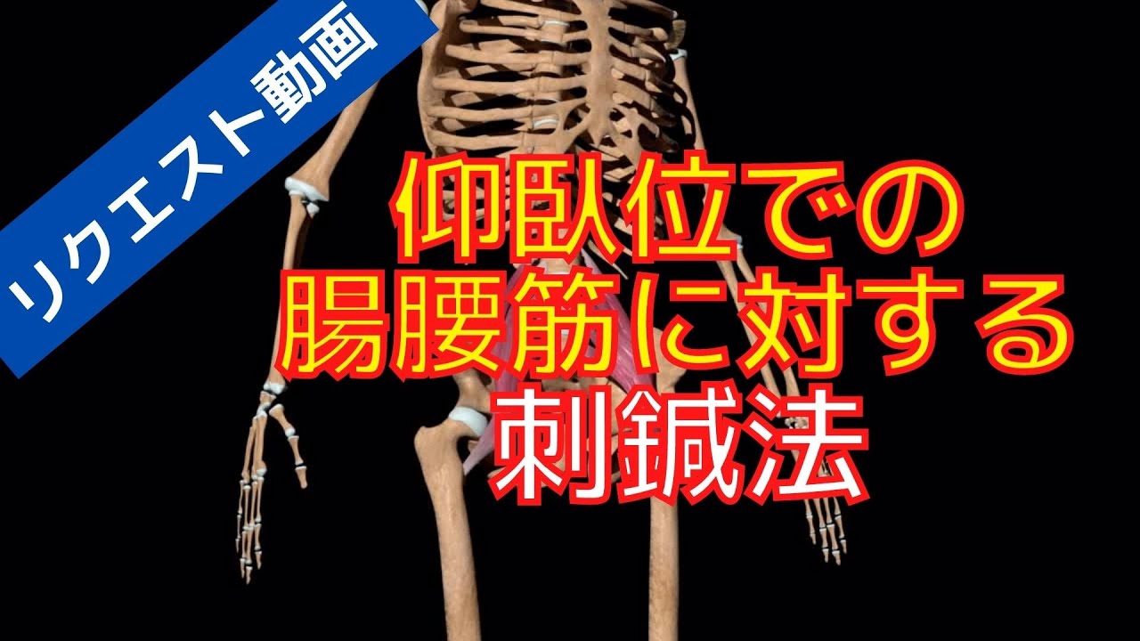 腸腰筋刺鍼！リクエスト動画、仰臥位での刺鍼法