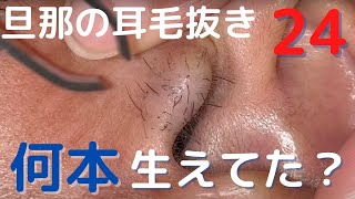 【旦那の耳毛24】　何本抜けるか数えてみた　ear hair plucking