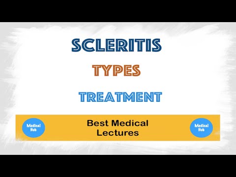 स्केलेराइटिस के लक्षण और उपचार व्याख्यान