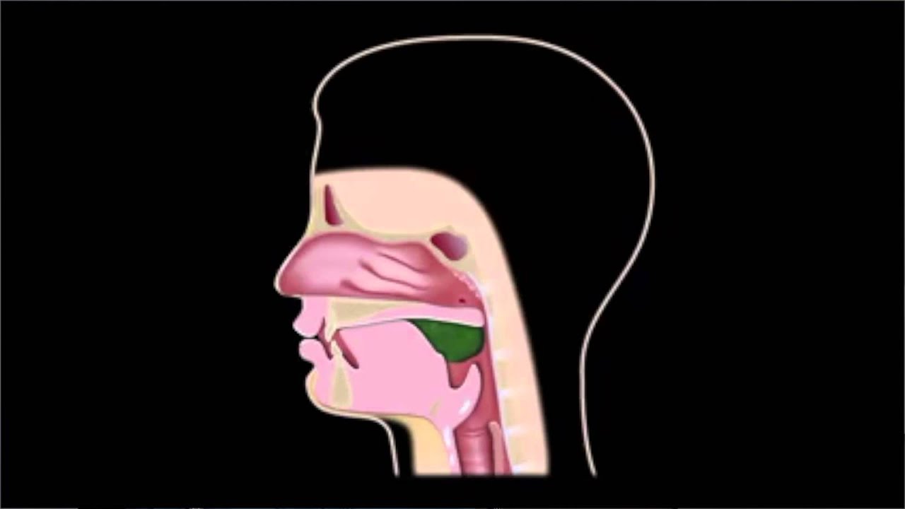 Dysphagia YouTube