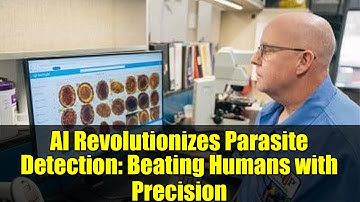 AI Revolutionizes Parasite Detection: Beating Humans with Precision