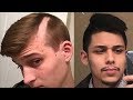 The Worst Haircut EVER