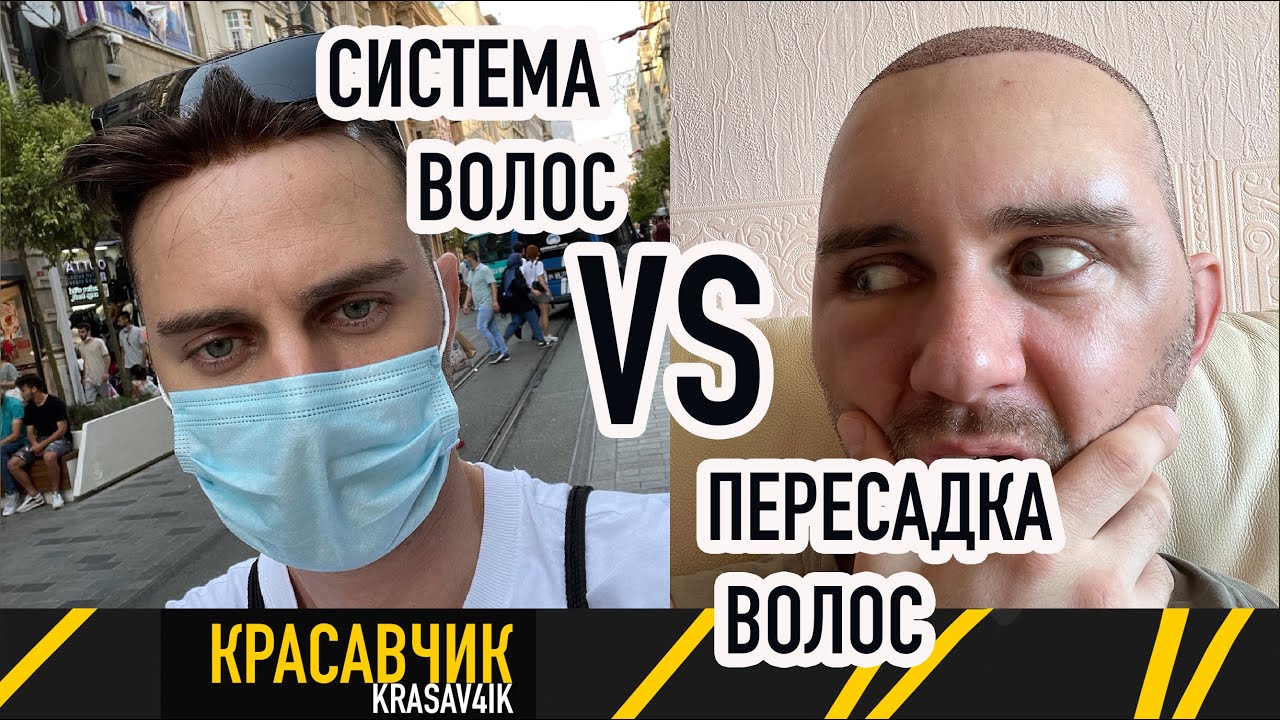 Сколько стоит пересадка волос в Турции? Делюсь личным опытом ...