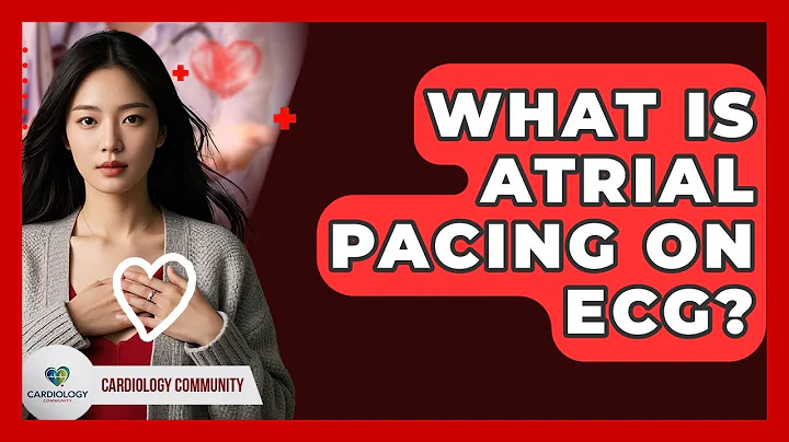 What Is Atrial Pacing On ECG? - Cardiology Community