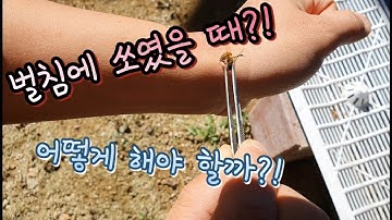 벌침에 쏘였을 때 대처방법!! 《What Should You Do If You are Stung?!》