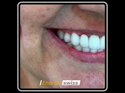 ผลสลากกินแบ่งรัฐบาล วันที่ 1 พย. 2567