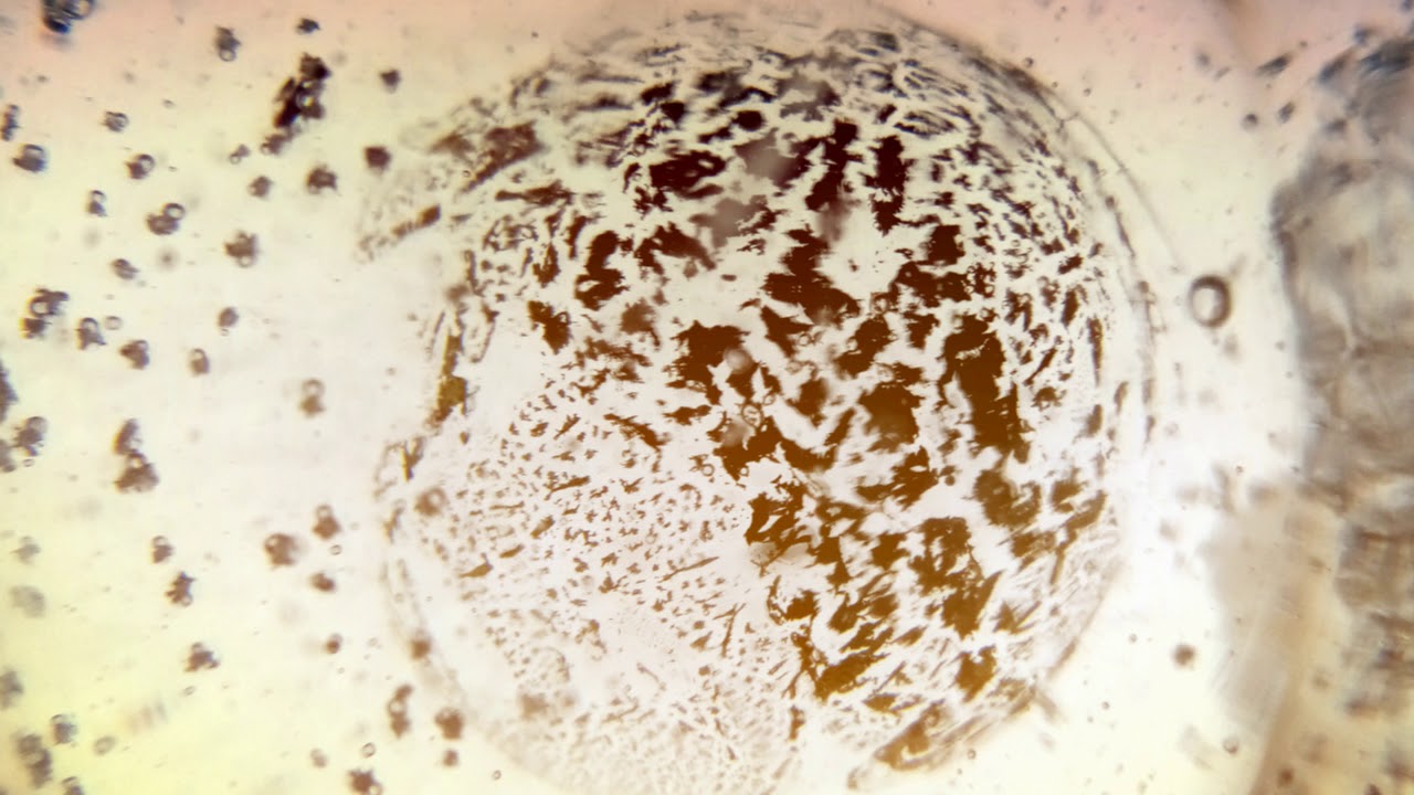 LUNG CHANNEL/MERIDIAN SYSTEM RESONANCE (TCM) | MAGNETO - DIELECTRIC ( SCALAR ) FIELDS