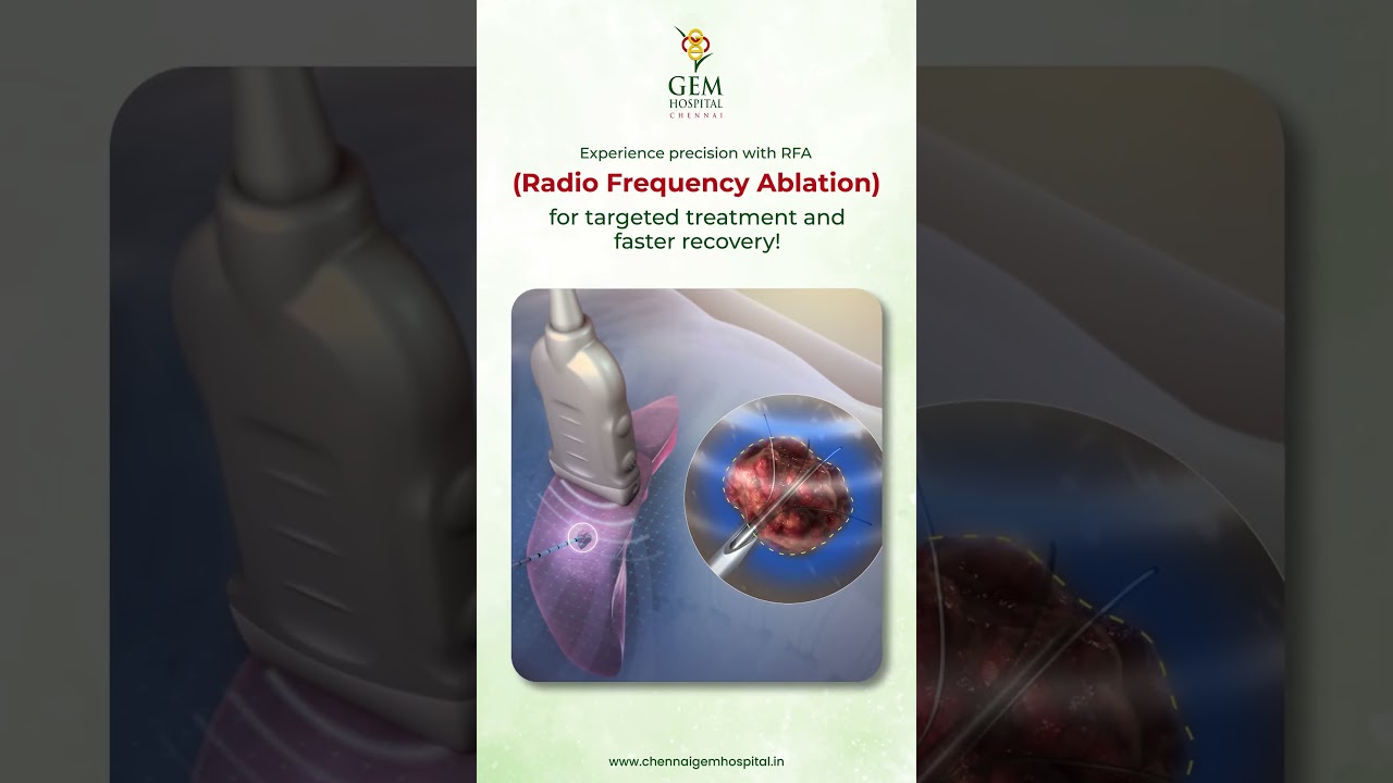 Precision Healing with RFA: Minimal Discomfort, Maximum Recovery! |