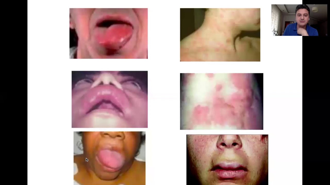 Solunum sistemi acilleri