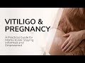 Vitiligo &amp; Pregnancy: What Expecting Moms Need to Know