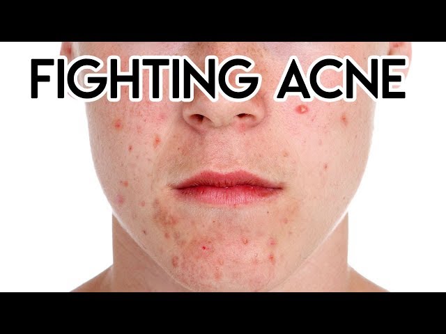 Fighting Acne