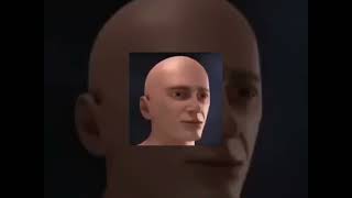 Brain Aneurysm Slowed Reverb