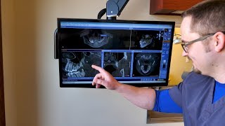 Hononegah Dental Laser Dentistry Roscoe Il Dentist