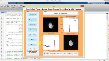 Based Brain Tumor Detection on DICOM Images Matlab Project with Source Code