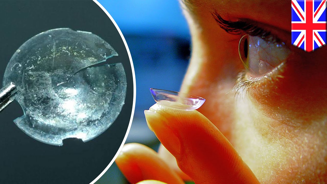 contact lens stuck in eyelid for 28 years tomonews youtube