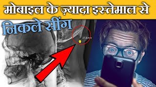 ⚠सावधान - मोबाइल का उपयोग करने से मानव खोपड़ी में सींग का विकास || Horns Growth In Human Skull screenshot 1