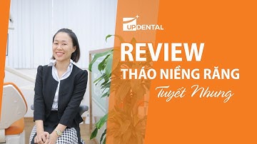 [Review niềng răng]: #199 Kết quả niềng răng của Tuyết Nhung