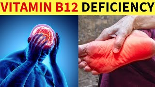 Top 10 Symptoms of Vitamin B12 Deficiency That You Should Not Ignore