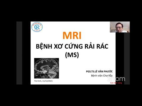 Video: 3 cách để giảm nguy cơ phát triển bệnh MS (bệnh đa xơ cứng)