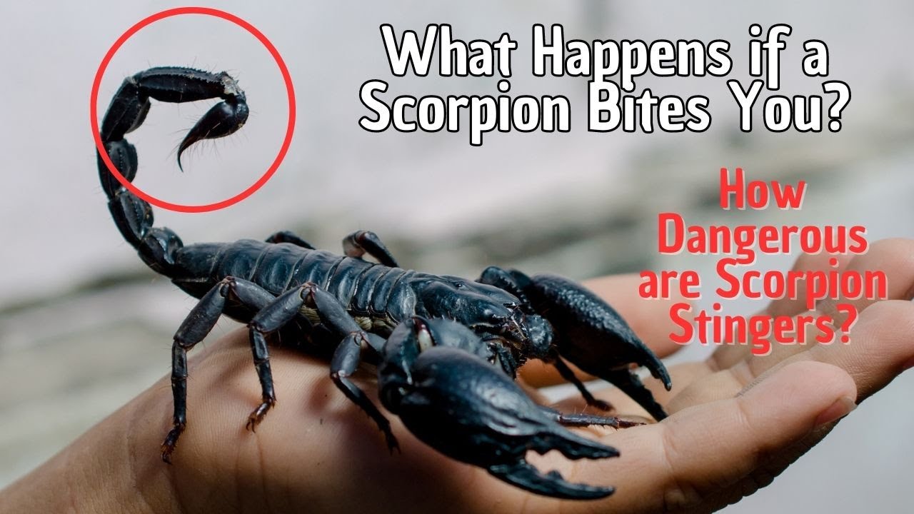 What Happens If A Scorpion Bites You How Dangerous Are Scorpion 