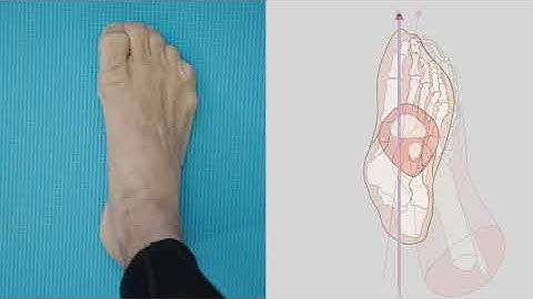 3 Minute Pitch - Towards a cyclic model of human gait