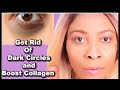 Some Of The Best Creams That Effectively Get Rid Of Dark Circles And Eye Bags