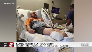 Hugo man's legs amputated after he fell into paper shredder at work