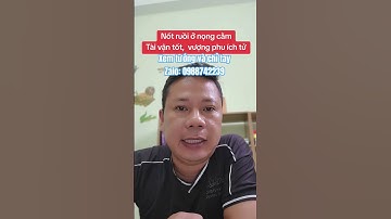 Nốt ruồi ở nọng cằm, tài vận tốt #tuvituongsohanoi #phongthuy #xemtuong