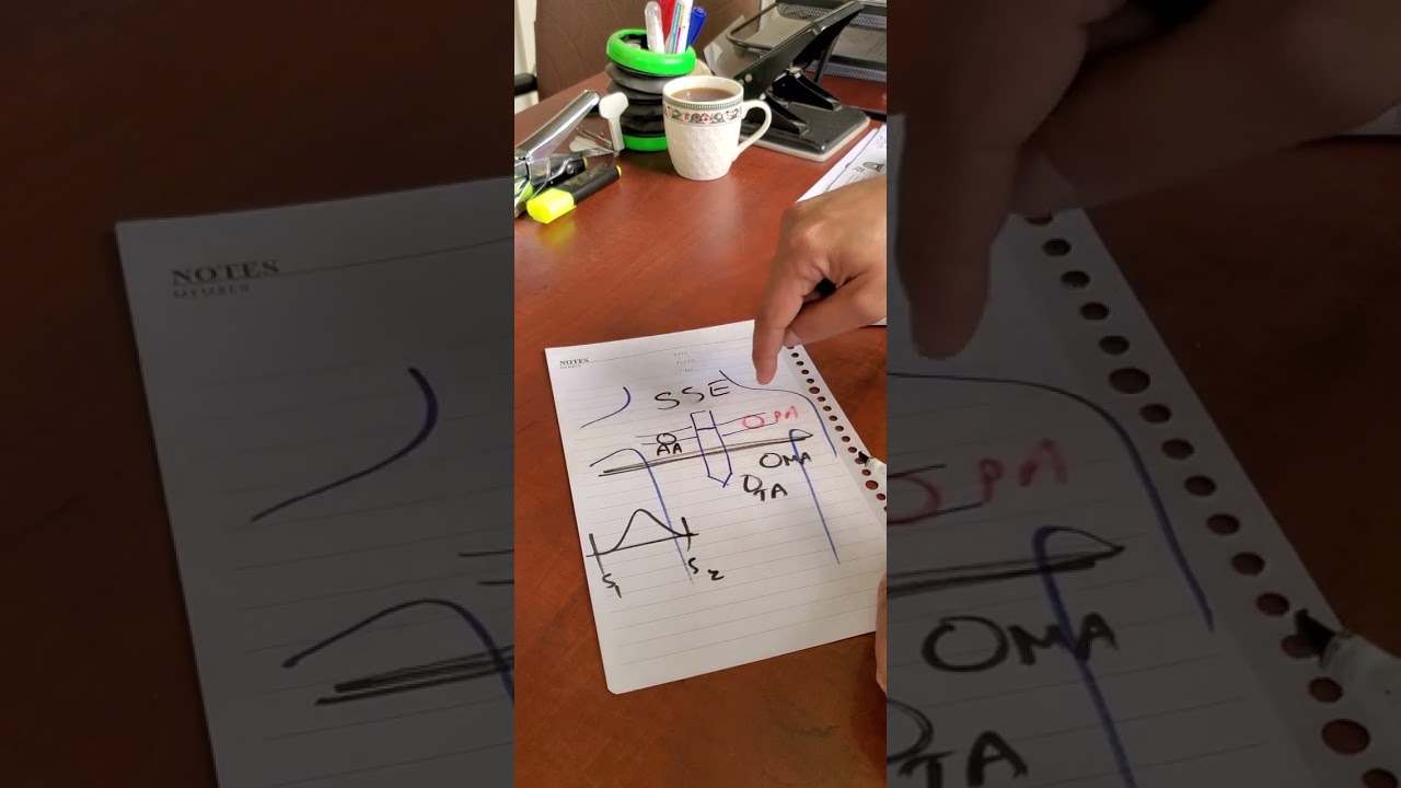 أصوات القلب Heart murmur