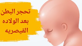 تحجر البطن بعد الولادة القيصرية | تعرّفي على أسباب تحجّر البطن بعد الولادة